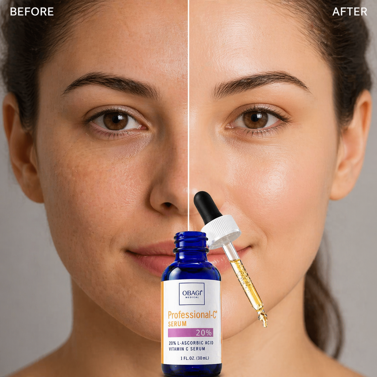 Obagi Medical Professional-C Serum 20% L-Ascorbic Acid (30ml / 1 fl. oz.)