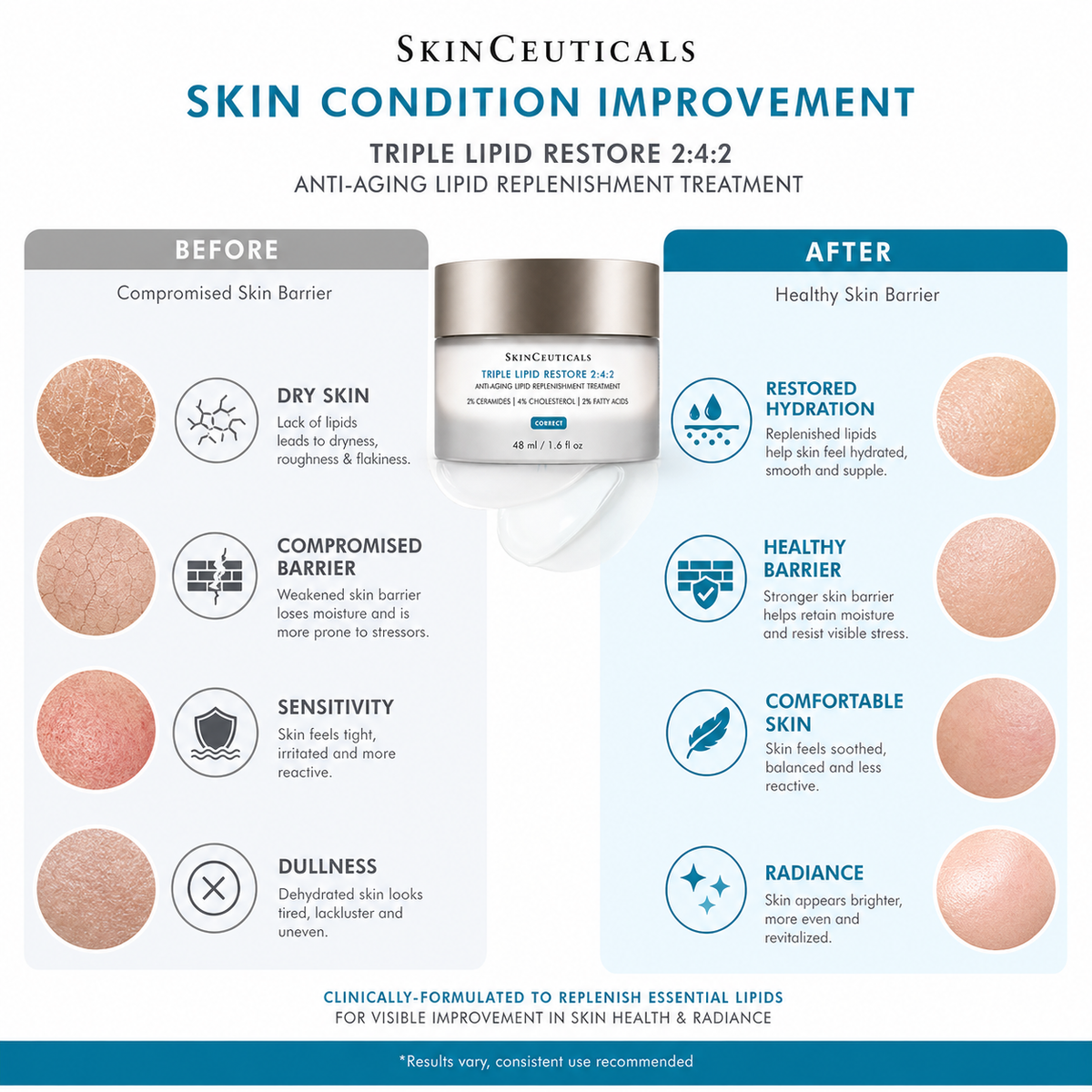 SkinCeuticals Triple Lipid Restore 2:4:2 (48ml / 1.6 fl. oz.)