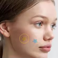 432 Colorful PE Pimple Patches Cute Star Shaped Pimple Cover Sticker Invisible Pimple Cover Removal Pimple Patch