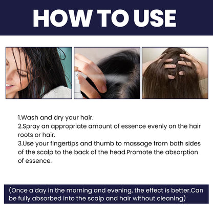 "NEX BRIT™ Ginger Hair Growth Spray"